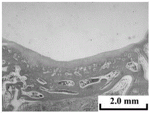 Hyaluronic acid/polylactic acid-glycollic acid copolymer composite cartilage repair material with radial orientation pore structure and preparation method thereof