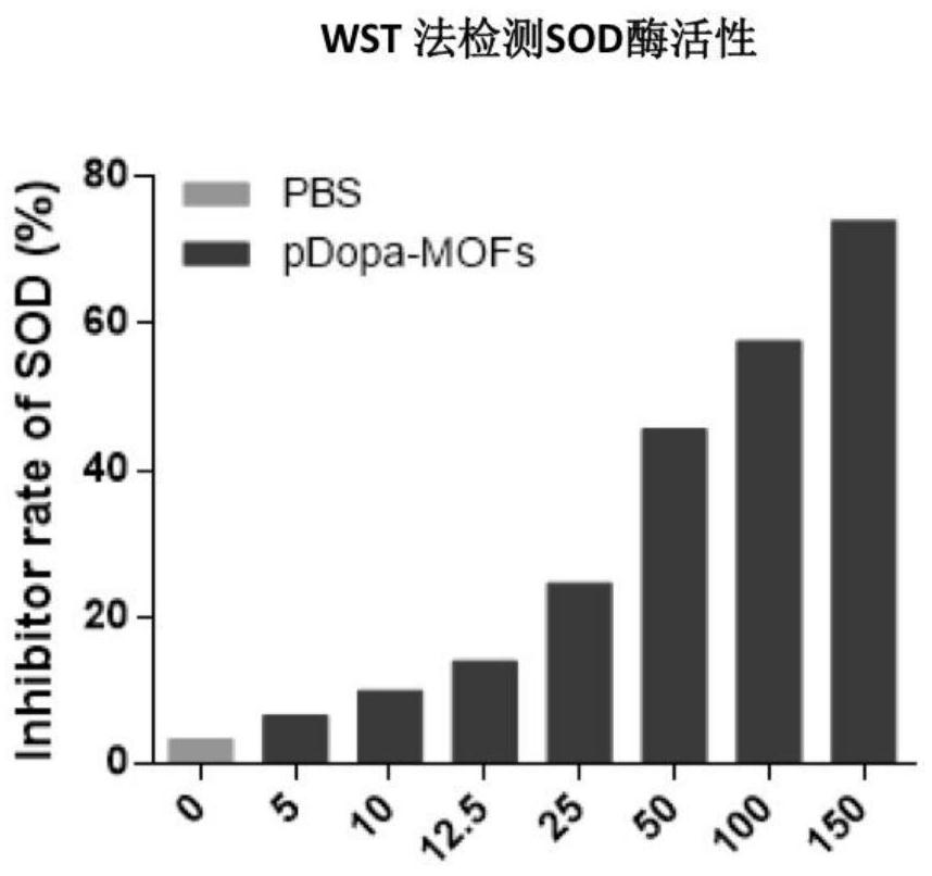 Preparation method of metal organic framework material for treating cerebral arterial thrombosis