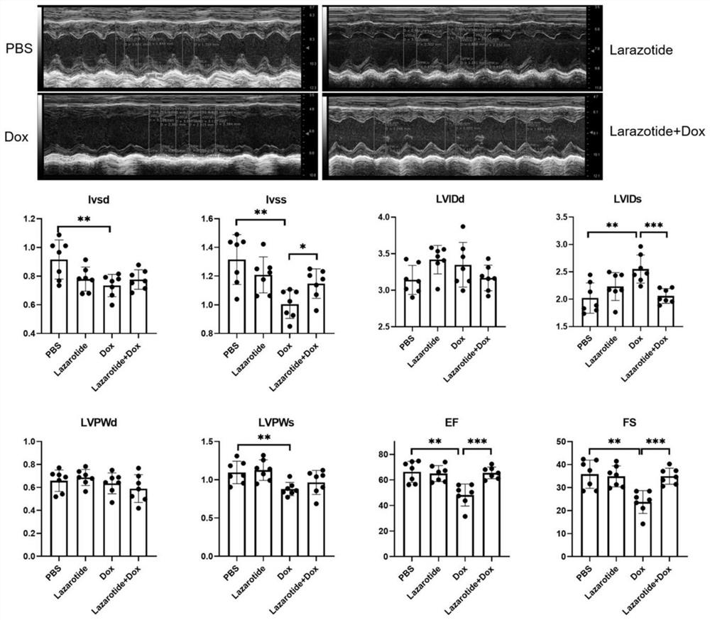 Application of laurazolette polypeptide in preparation of medicine for relieving doxorubicin cardiotoxicity