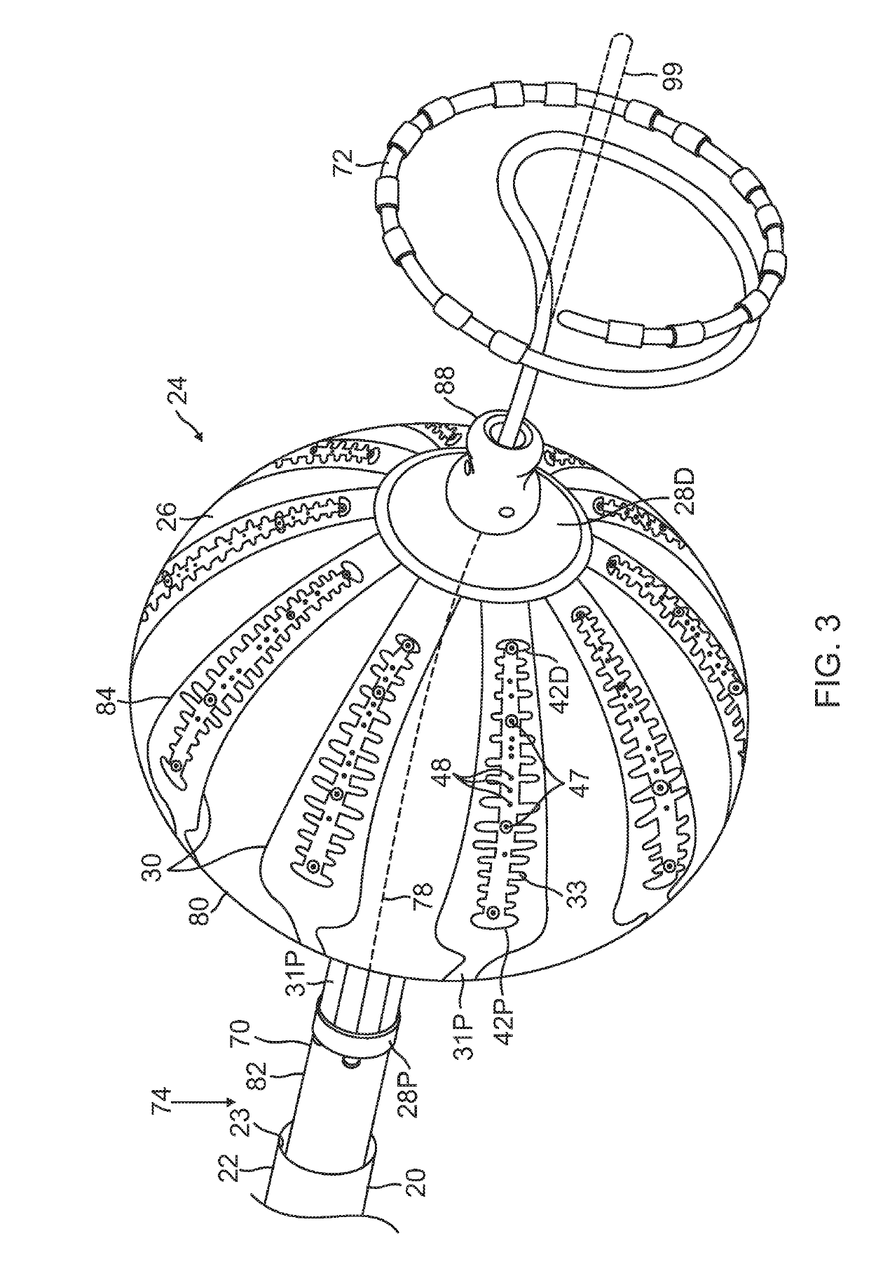 Irrigated electrophysiology catheter with distinguishable electrodes for multi-electrode identification and orientation under 2-d visualization