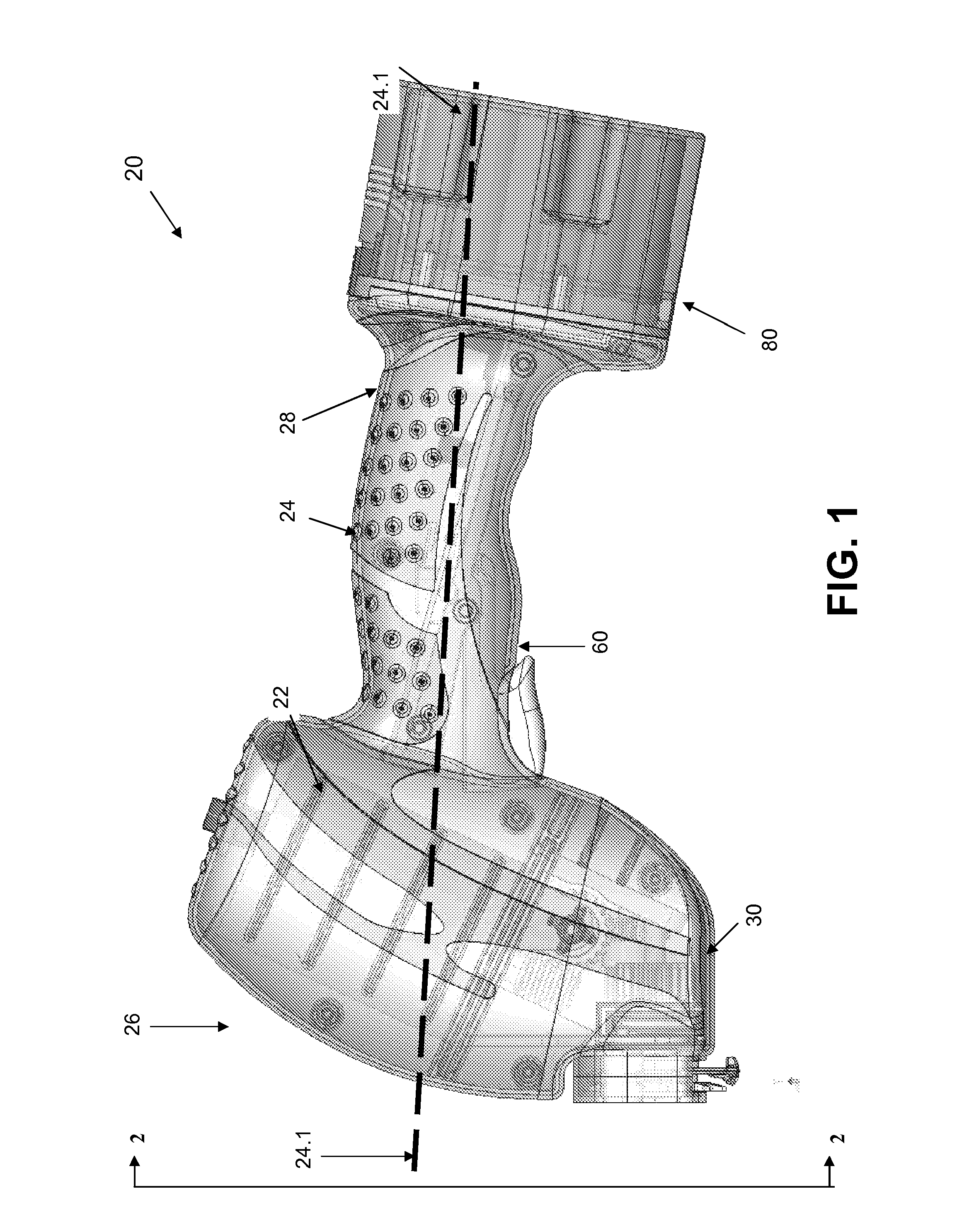 Cast removal system