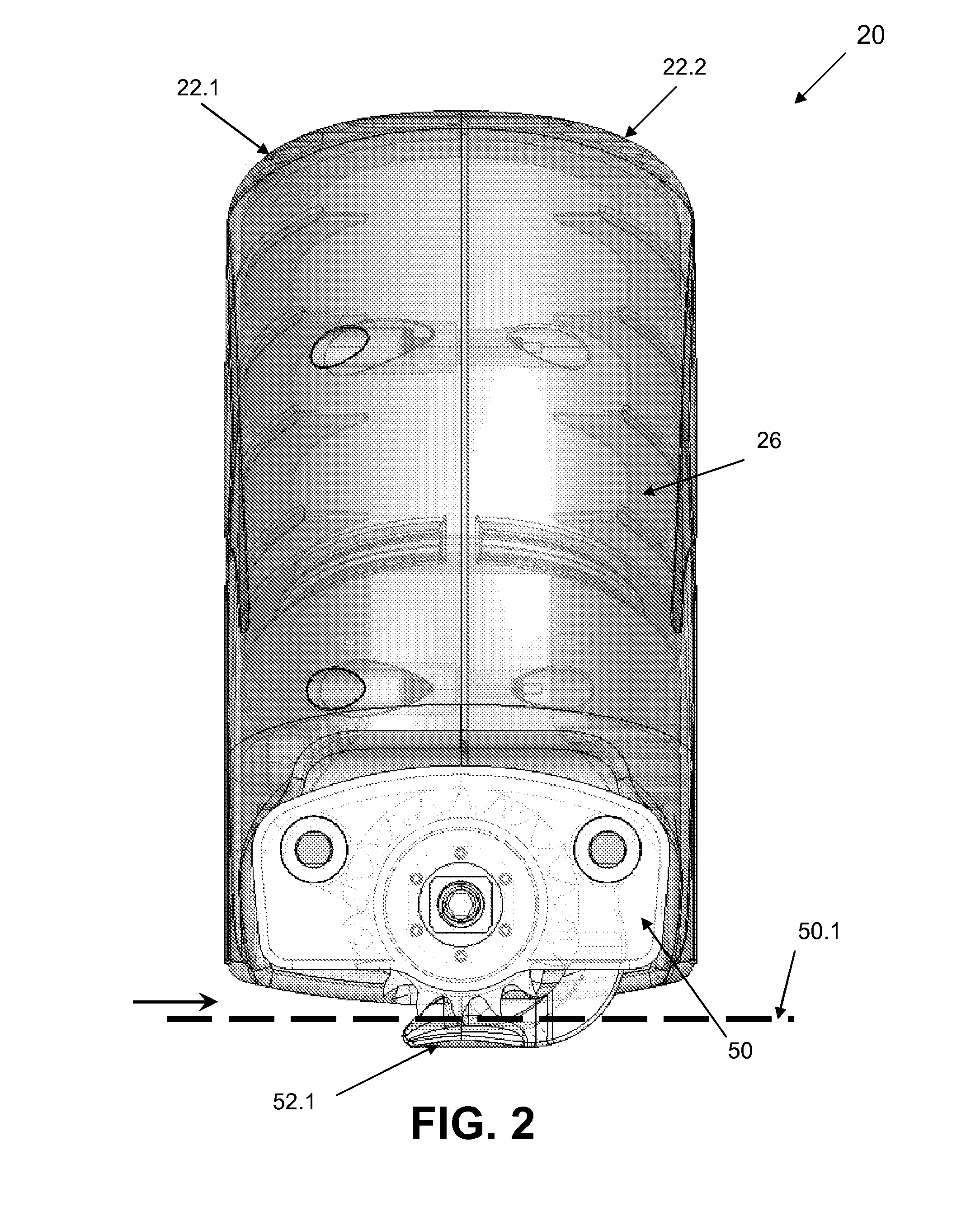 Cast removal system