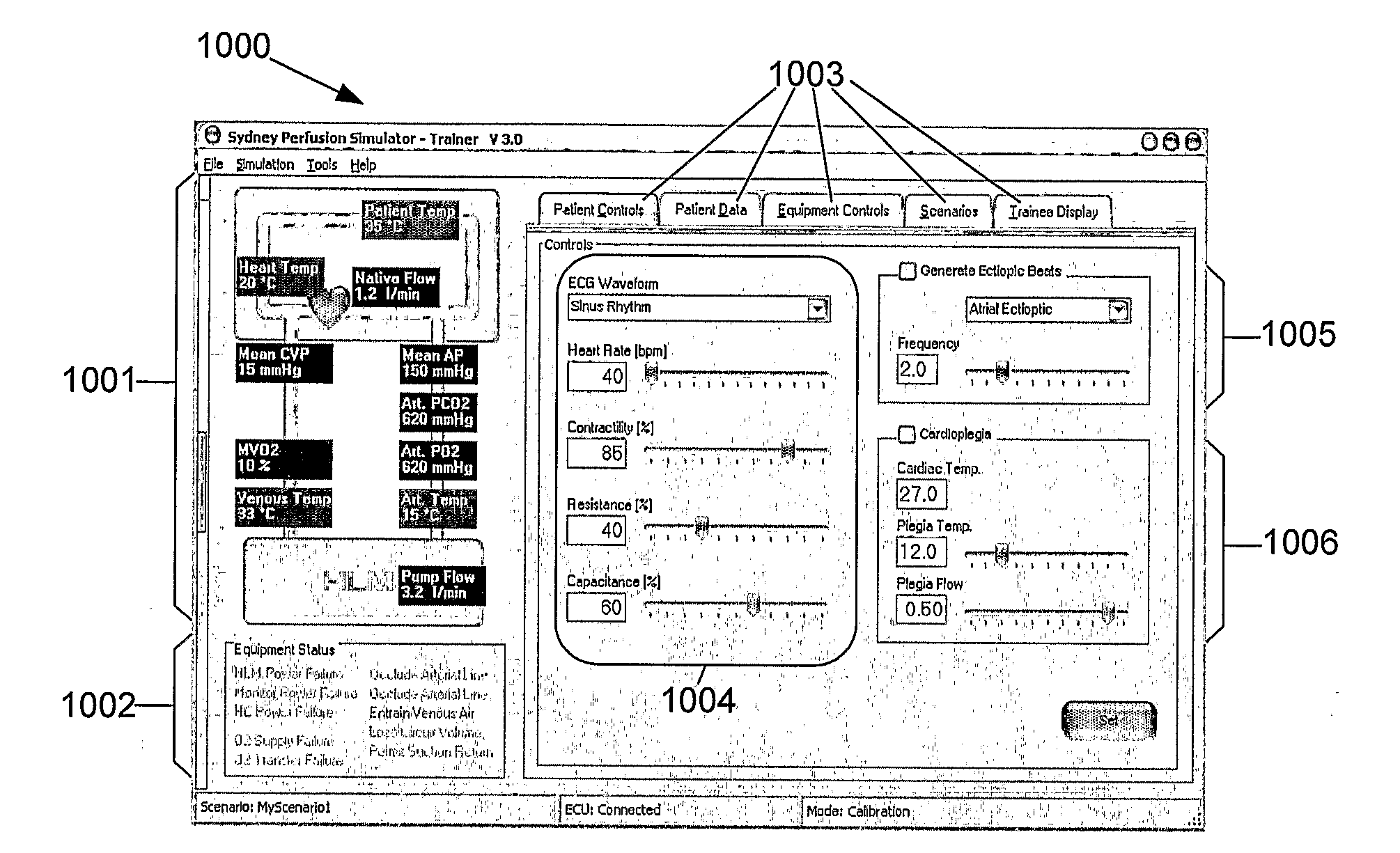 Perfusion Method and Apparatus