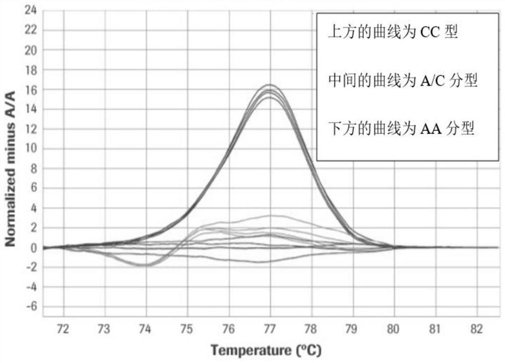 Perch immunity-related SNP site and application thereof in breeding