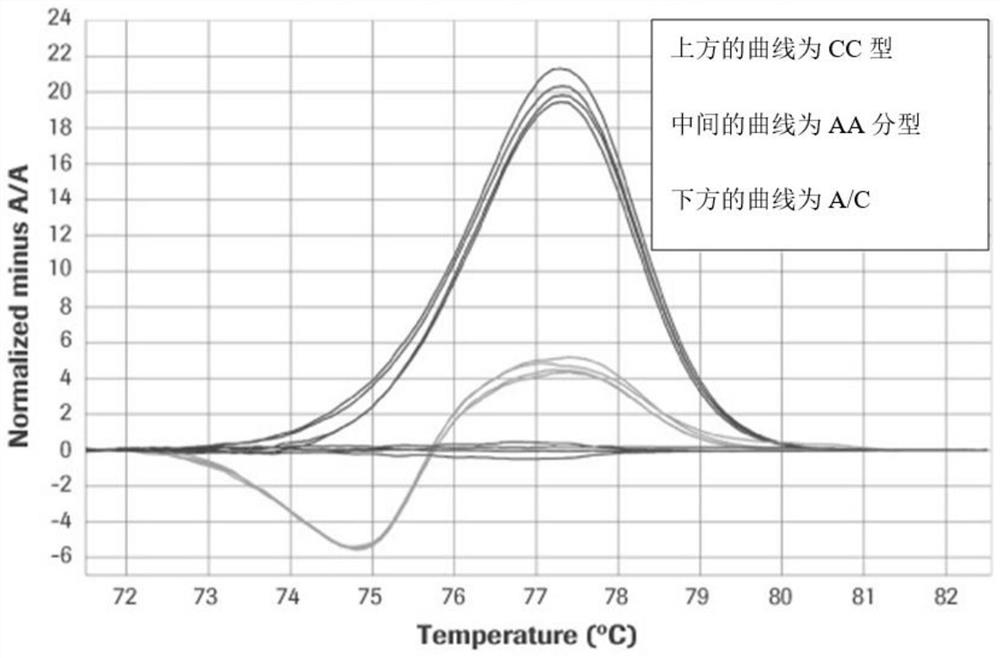 Perch immunity-related SNP site and application thereof in breeding