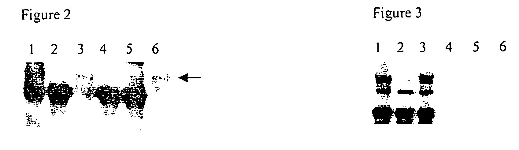 Derivatives of the il-2 receptor gamma chain, their production and use