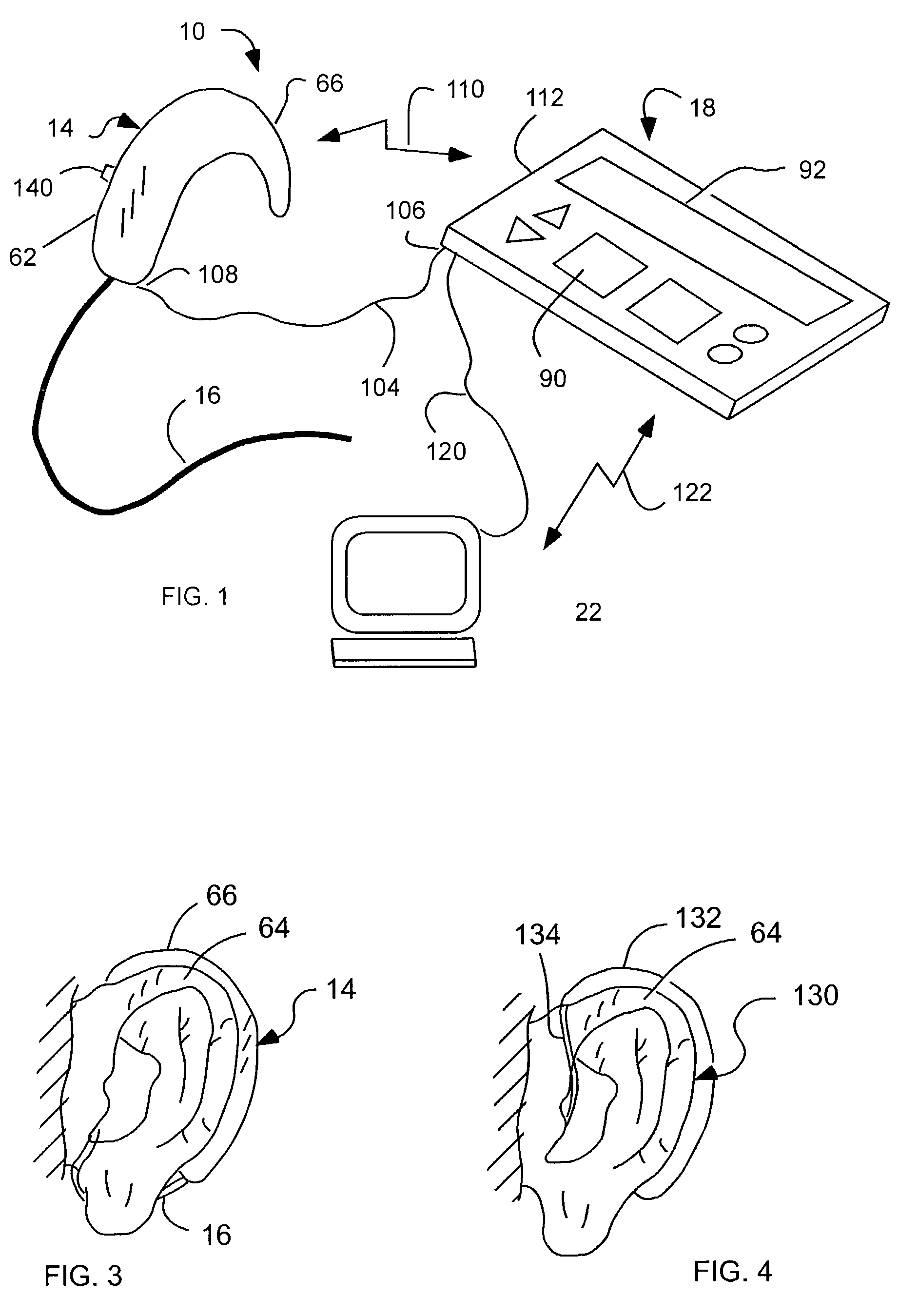 Cochlear drug delivery system and method