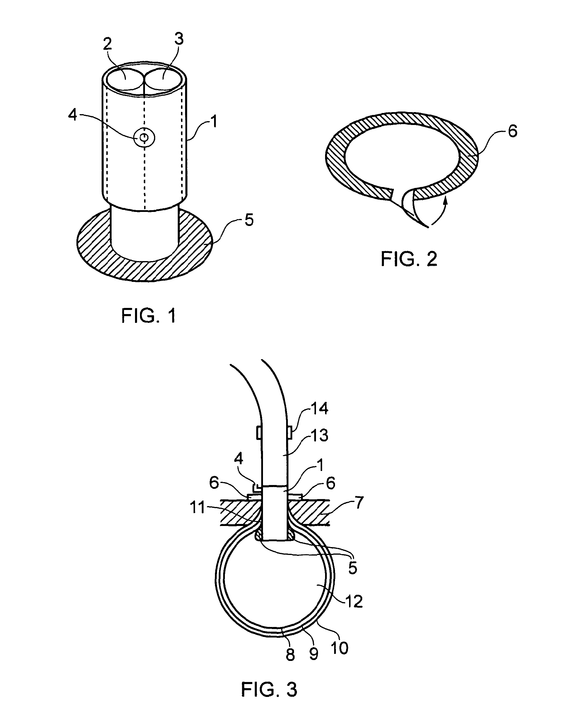 Medical device: laparoscopic bag