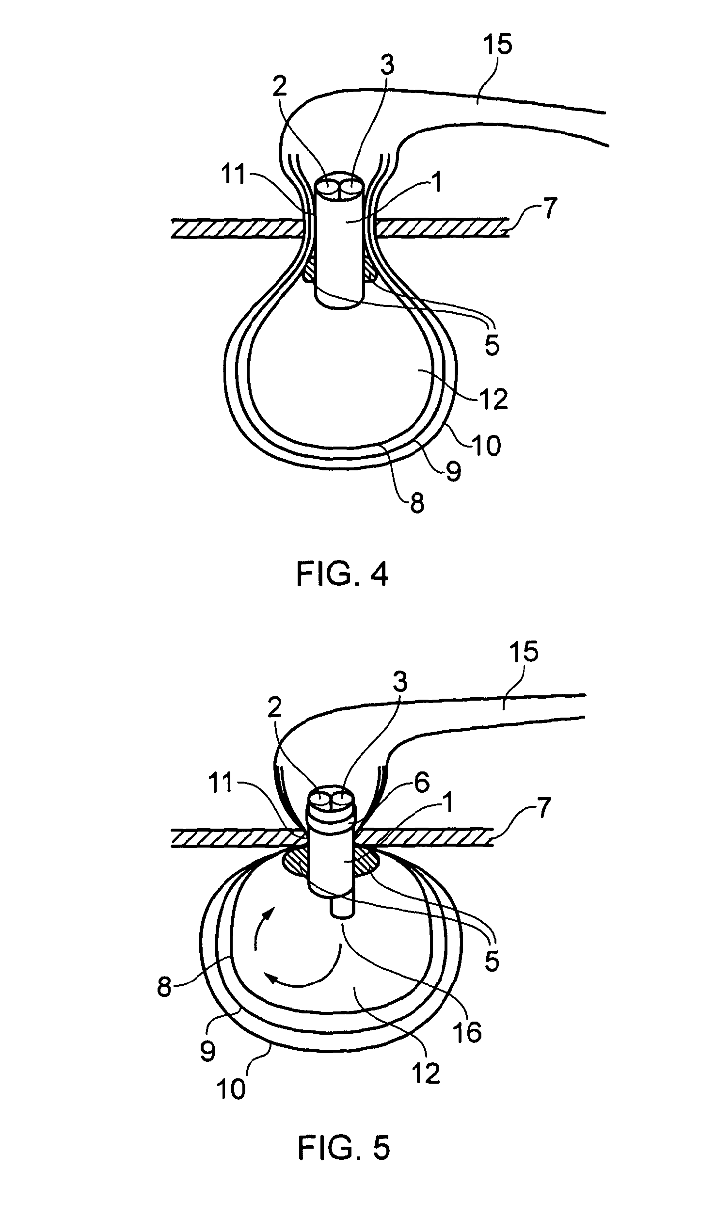 Medical device: laparoscopic bag