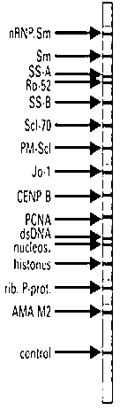 Kit for detecting antinuclear antibody spectrum related to autoimmune diseases (AIDs)