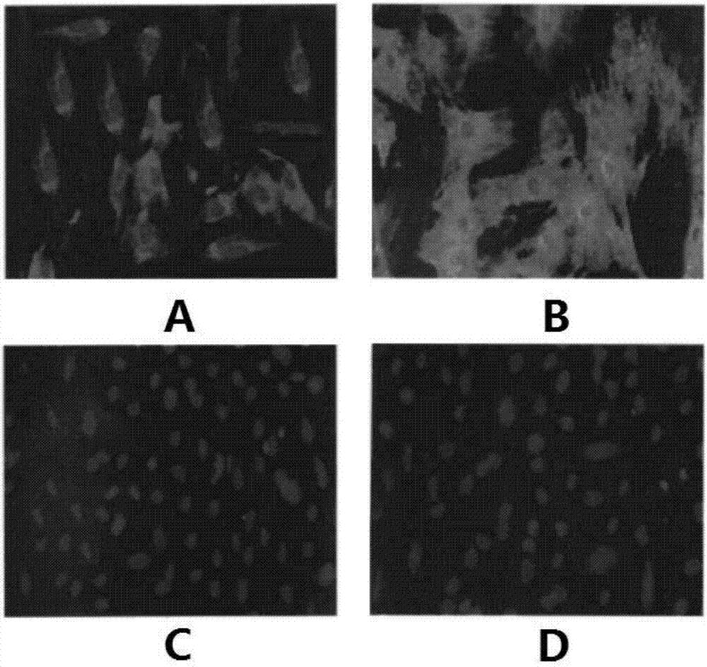 Applications of non-coding RNA target and inhibitor thereof in preparing medicines capable of promoting osteogenic differentiation of mesenchymal stem cells