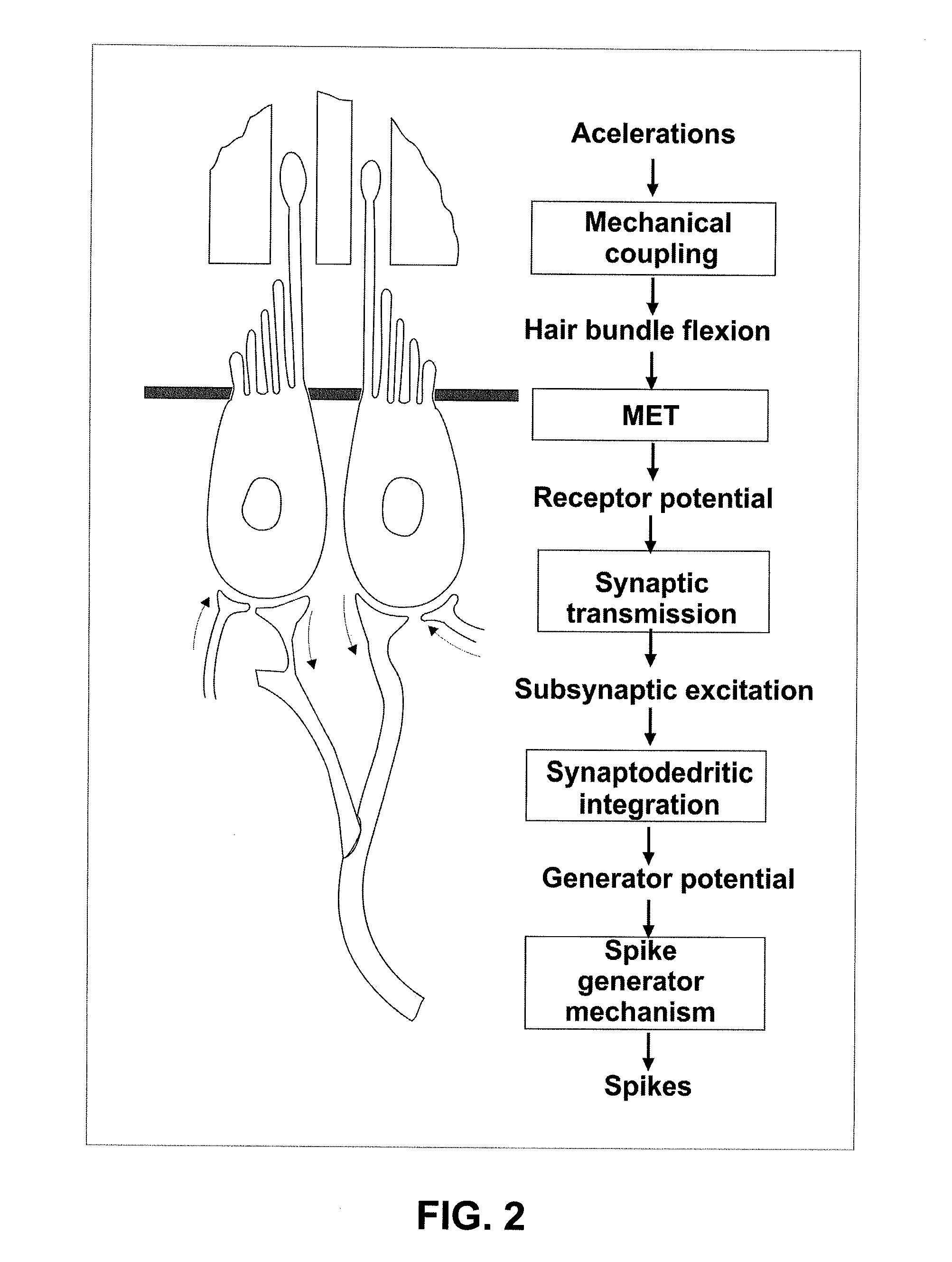 Vestibular prosthesis