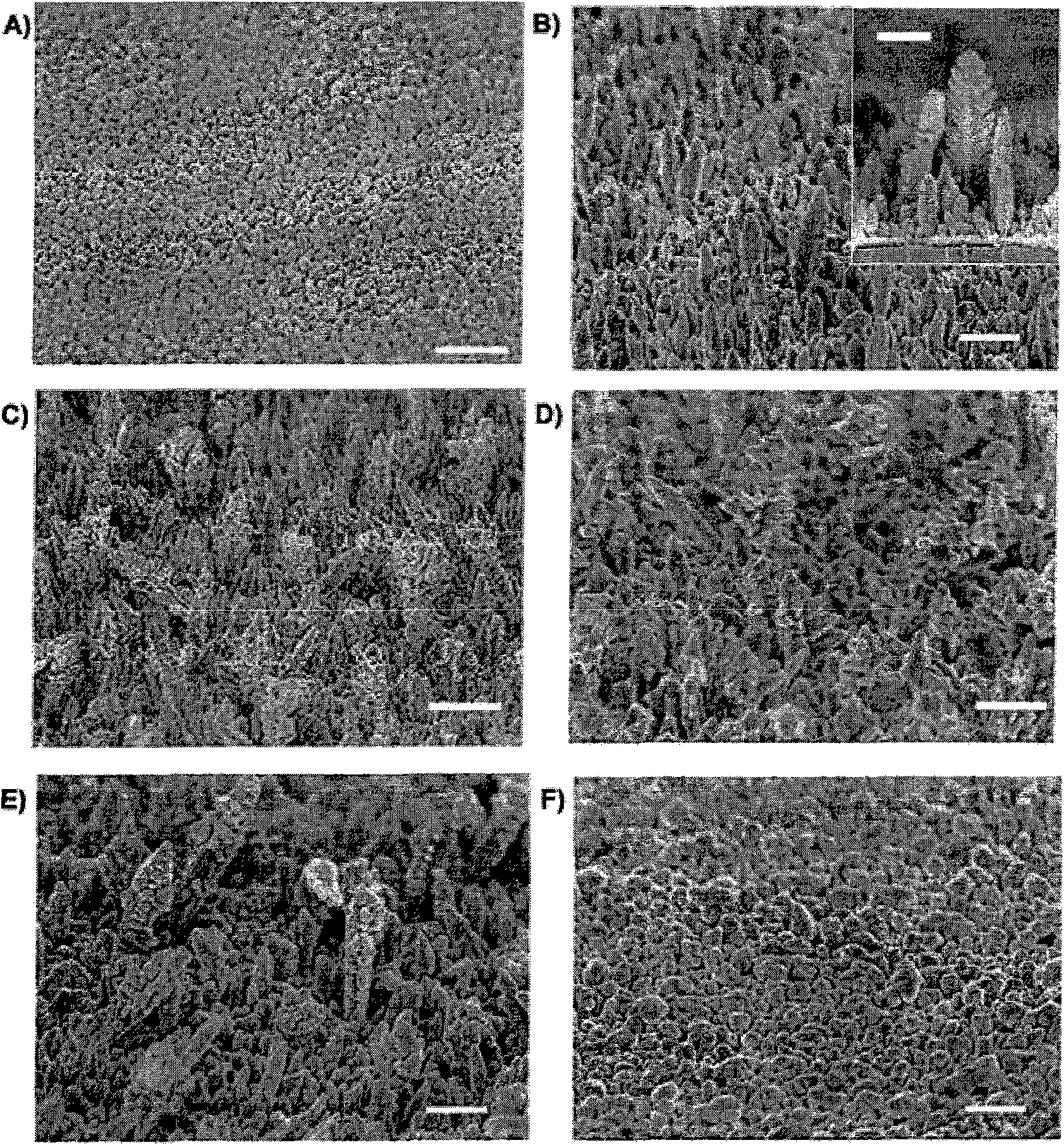 Photoelectrochemistry biosensor and preparation method thereof