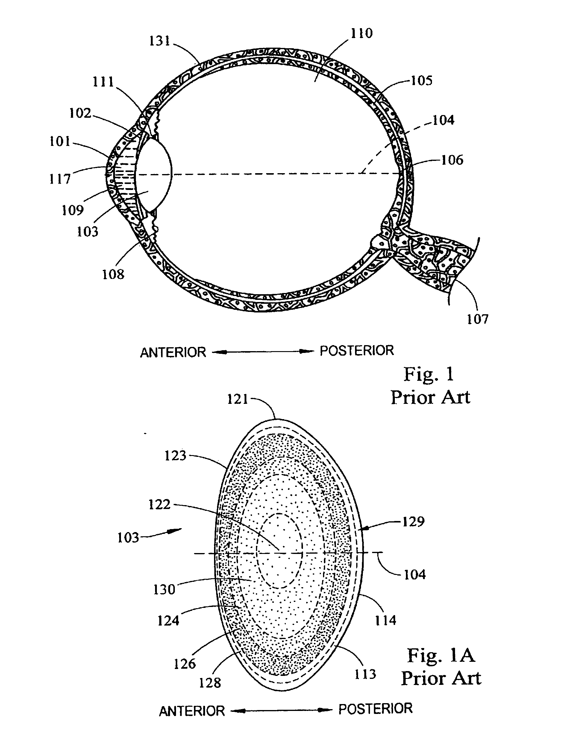 System and apparatus for delivering a laser beam to the lens of an eye