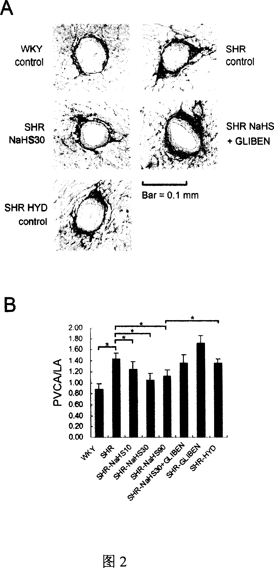 Use of hydrogen sulfide and its donor sodium hydrosulfide in the production of medicaments