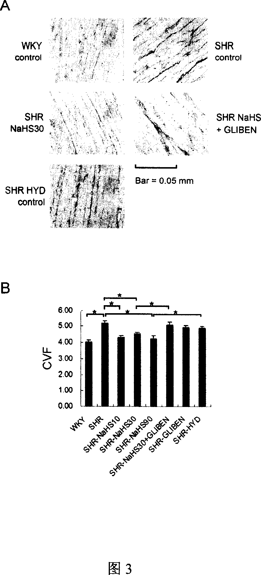 Use of hydrogen sulfide and its donor sodium hydrosulfide in the production of medicaments