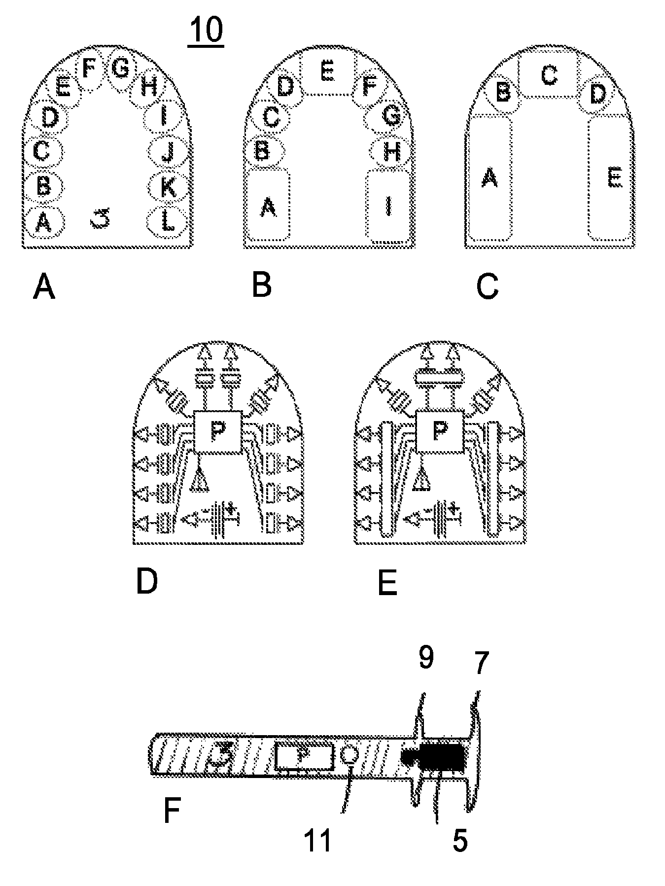 Differential vibration of dental plate