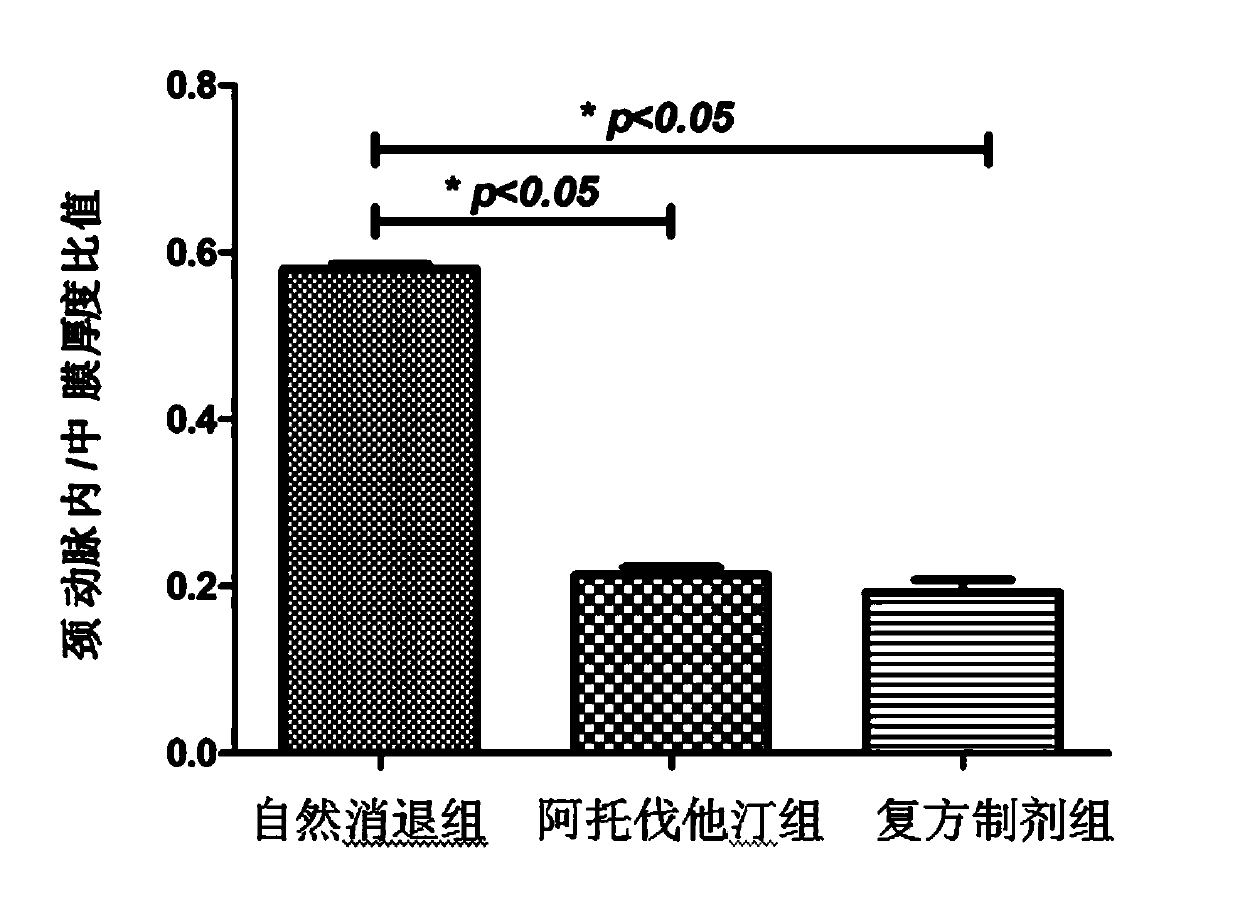 Compound traditional Chinese medicine preparation with effect of atherosclerotic plaque regression and reversal