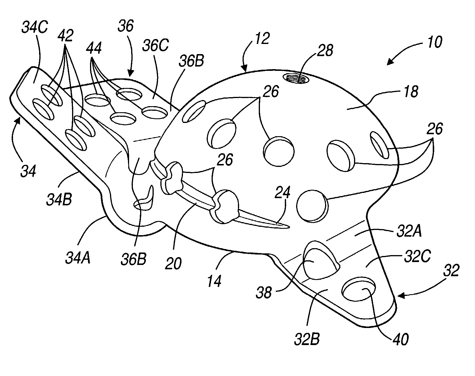 Method and apparatus for acetabular reconstruction