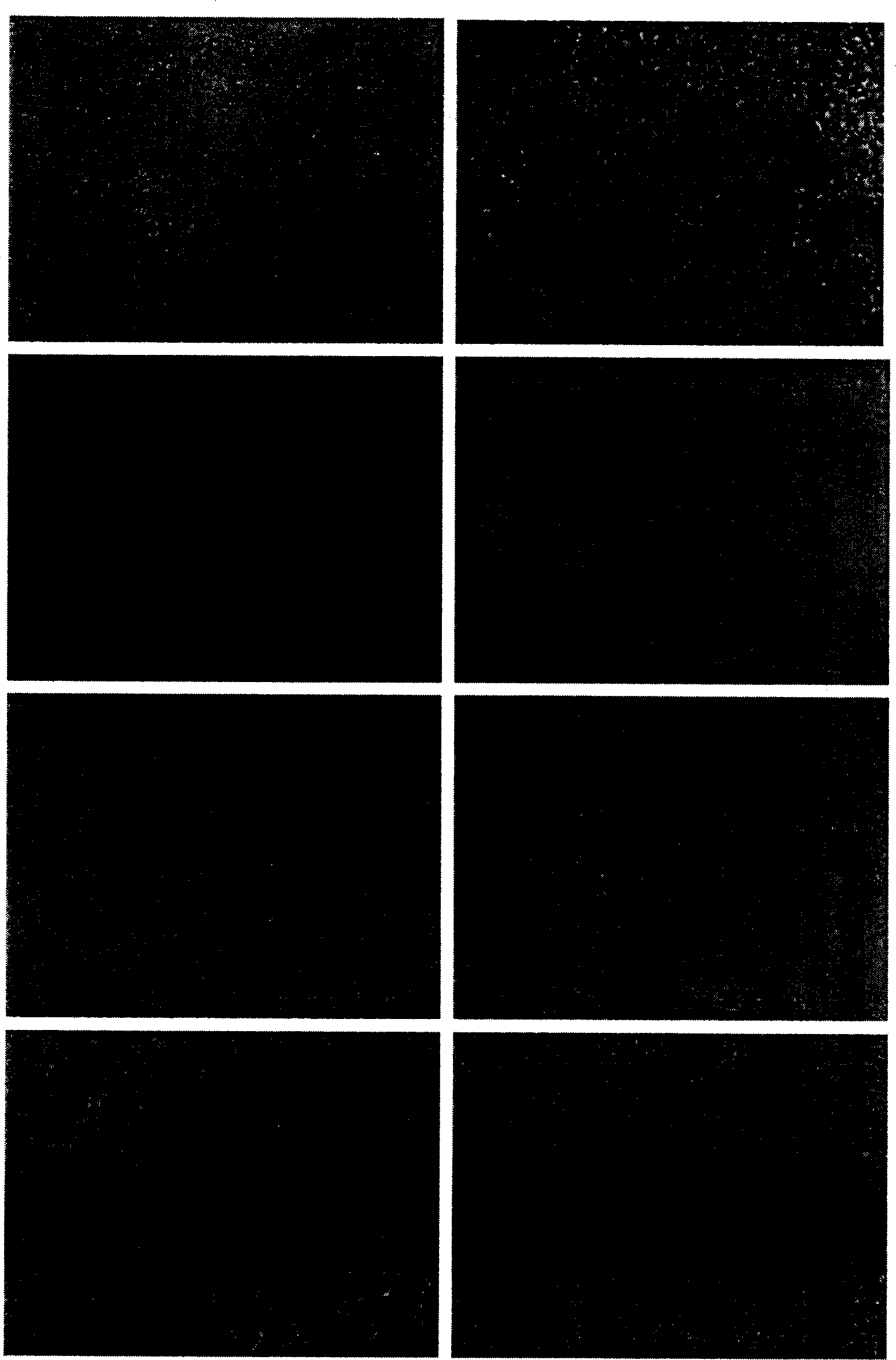 Medicine composite containing icaritin and demethylicaritin and its application