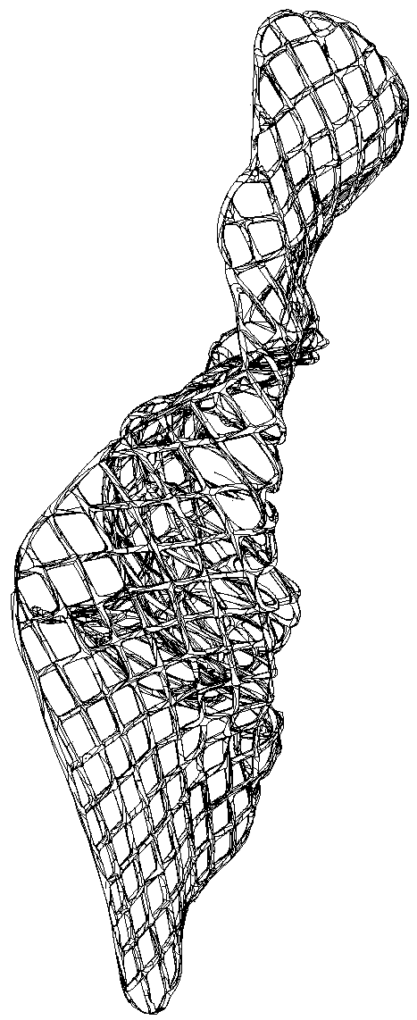 Pelvic tamponade prosthesis