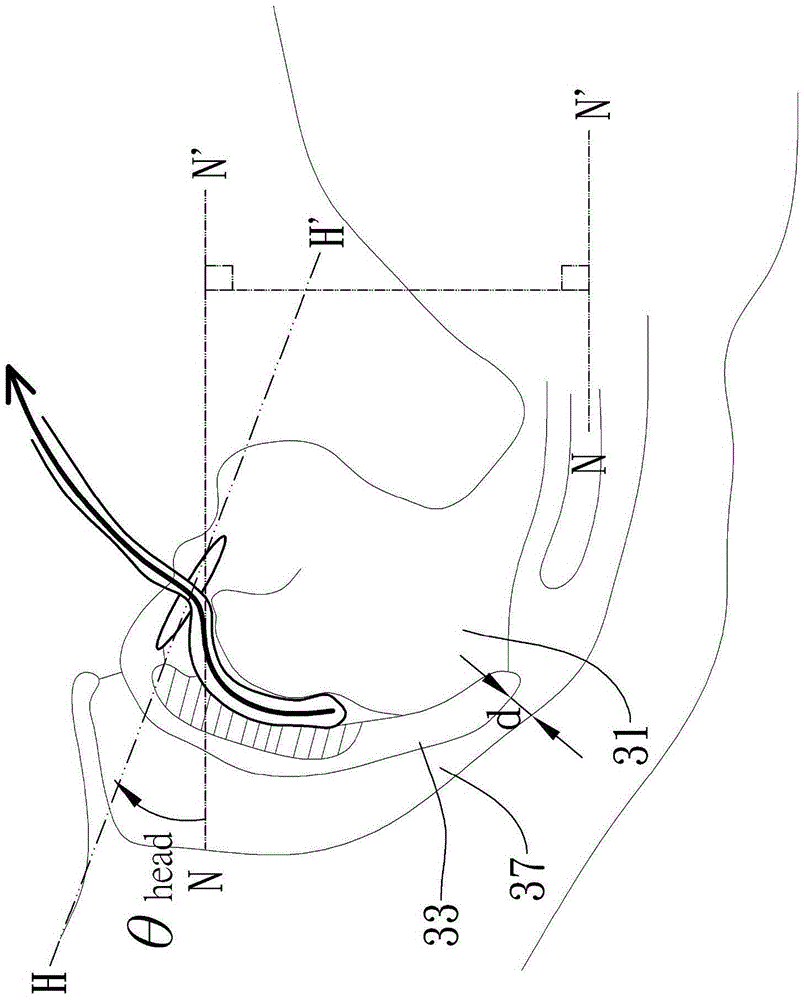 System for improving patency degree of upper respiratory tract and method thereof