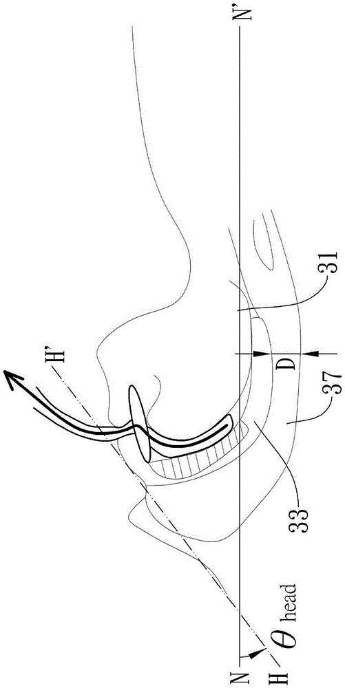 System for improving patency degree of upper respiratory tract and method thereof