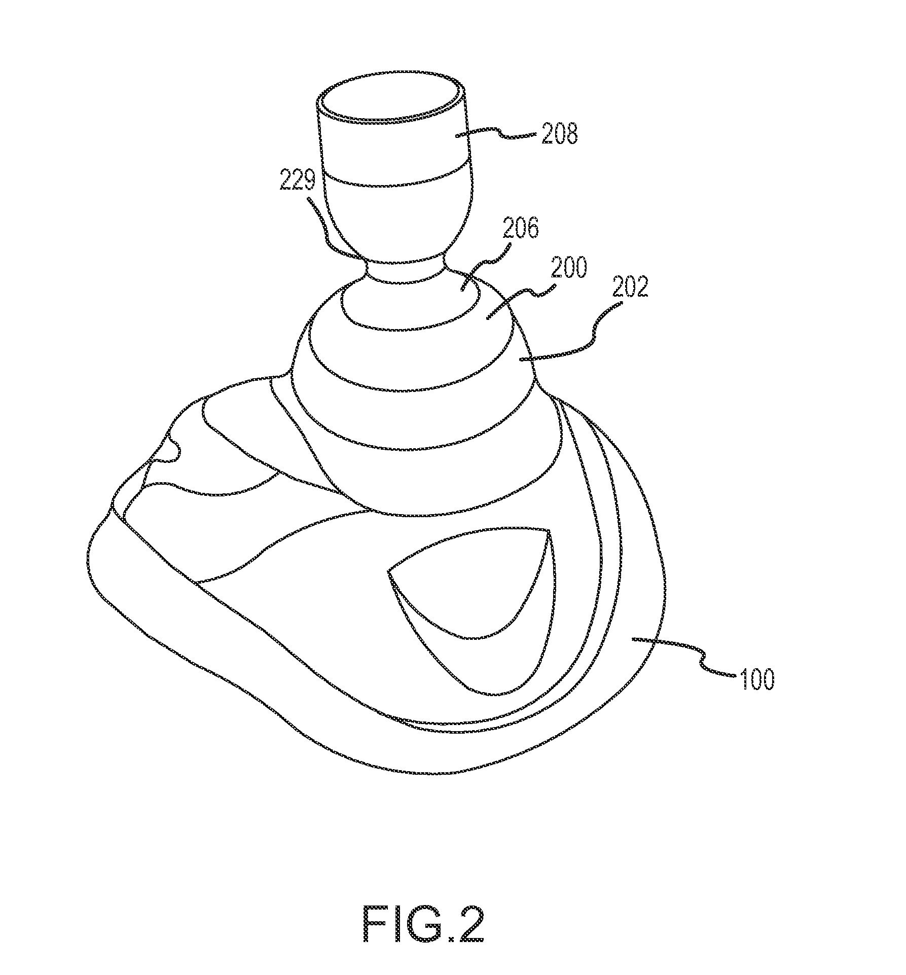 Vacuum and positive pressure ventilation systems and methods for intrathoracic pressure regulation