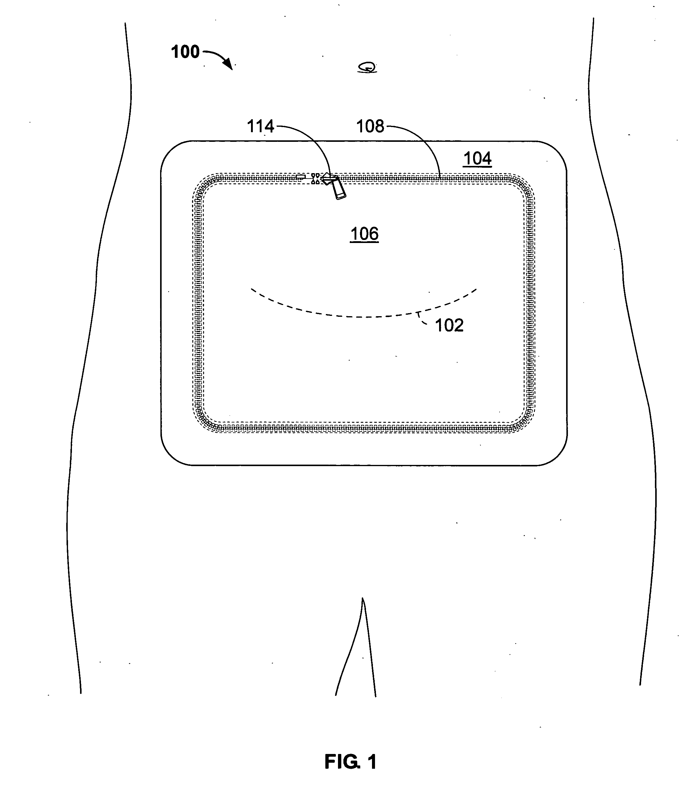 Device to facilitate wound care