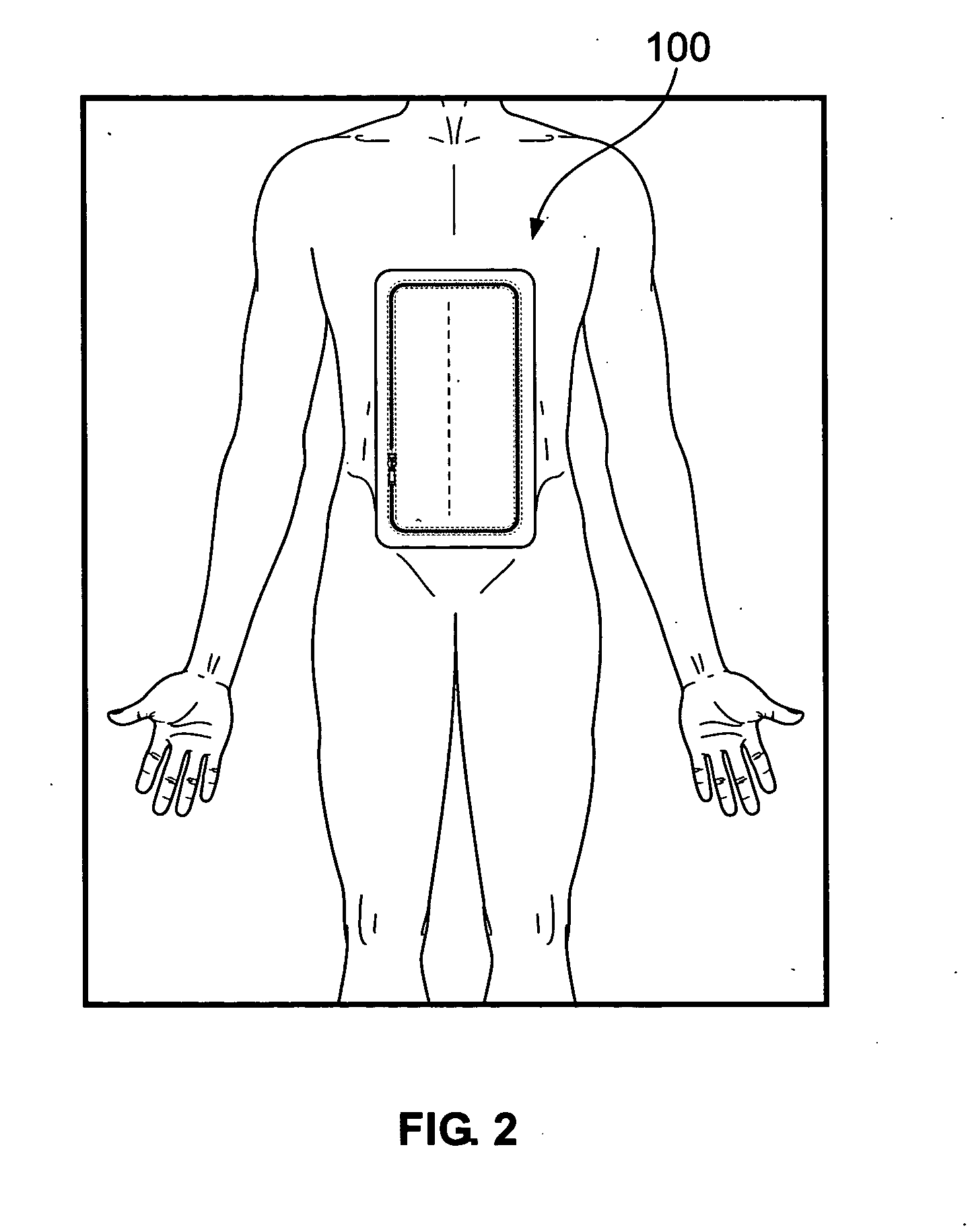 Device to facilitate wound care