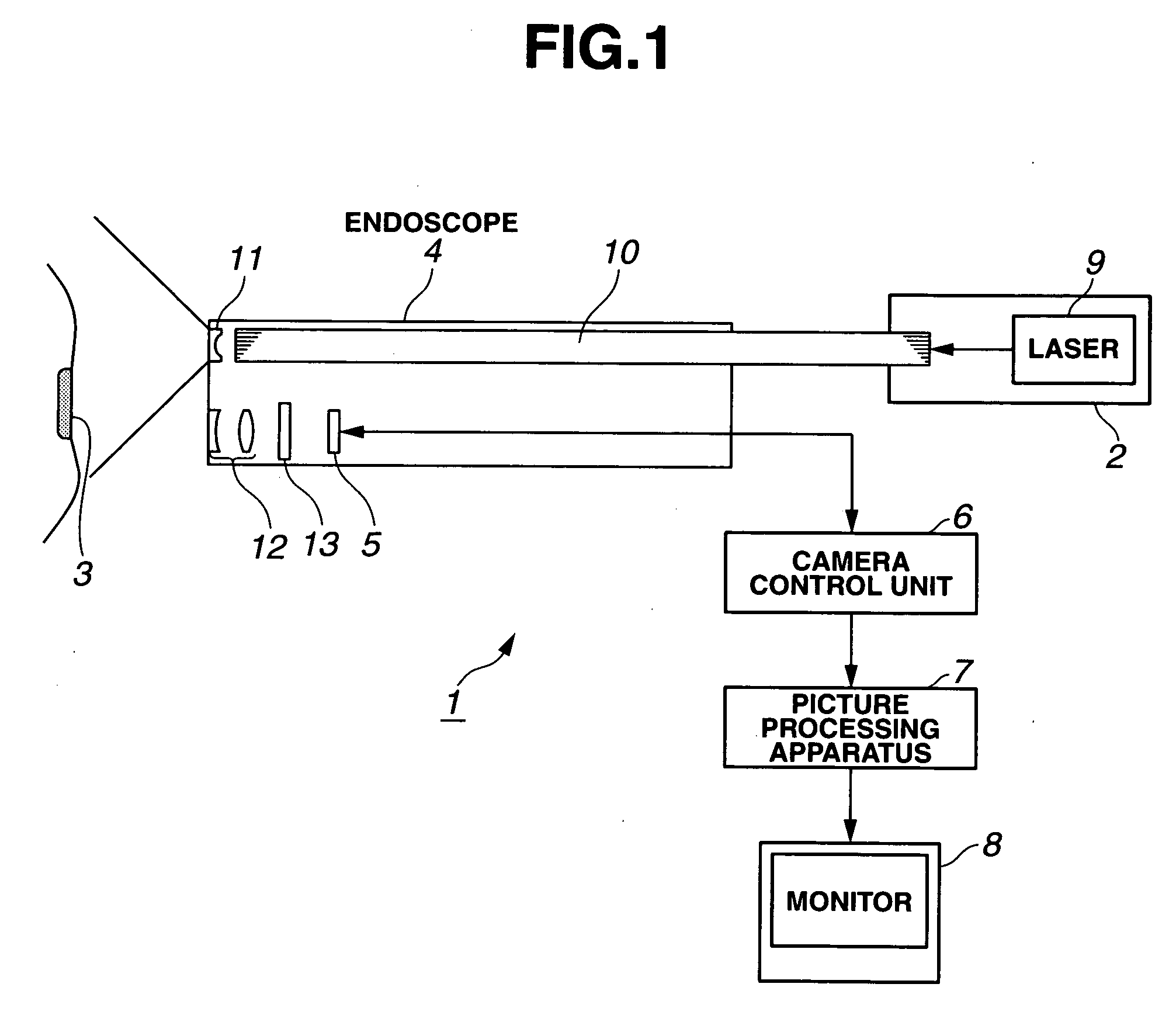 Fluorescence observation endoscope apparatus and fluorescence observation method