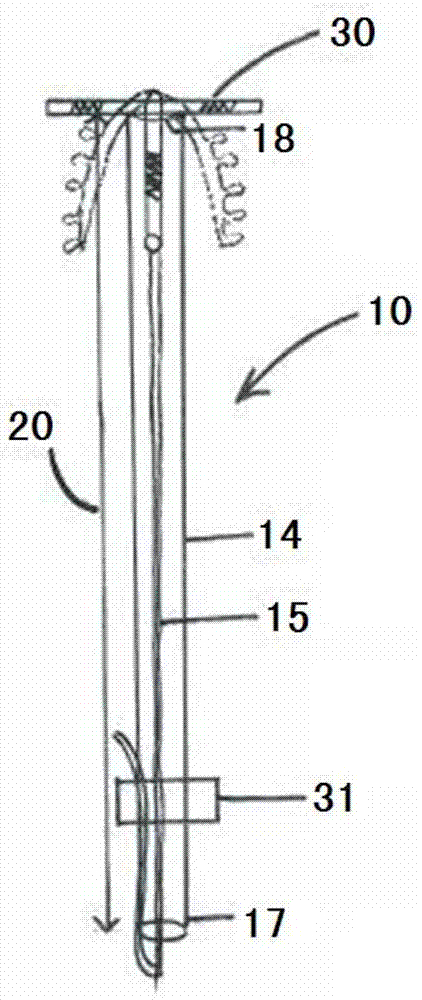 Tool and method for postpartum insertion of intrauterine contraceptive device