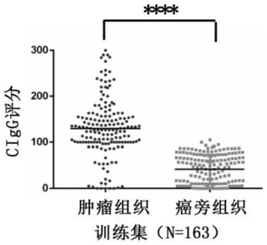 Use of tumor-derived IgG in the diagnosis or prognosis of pancreatic cancer