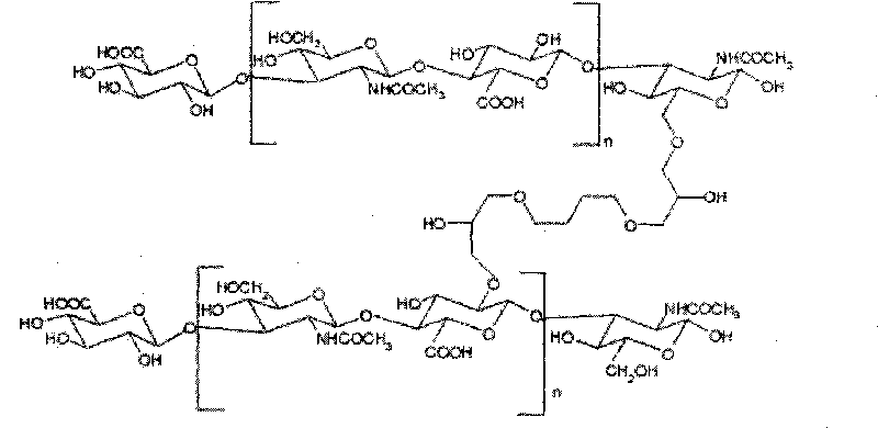 Medical cross-linking sodium hyaluronate gel derivative product and preparation method thereof