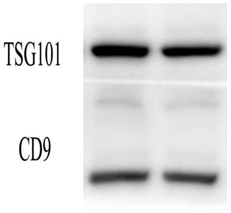 Application of exosome gene, prostate cancer detector, and detection kit and detection device thereof