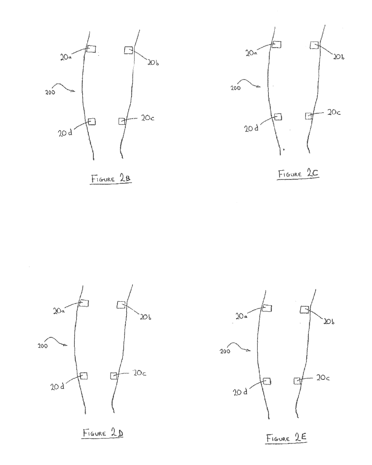 Method and Device for Enhanced Blood Flow