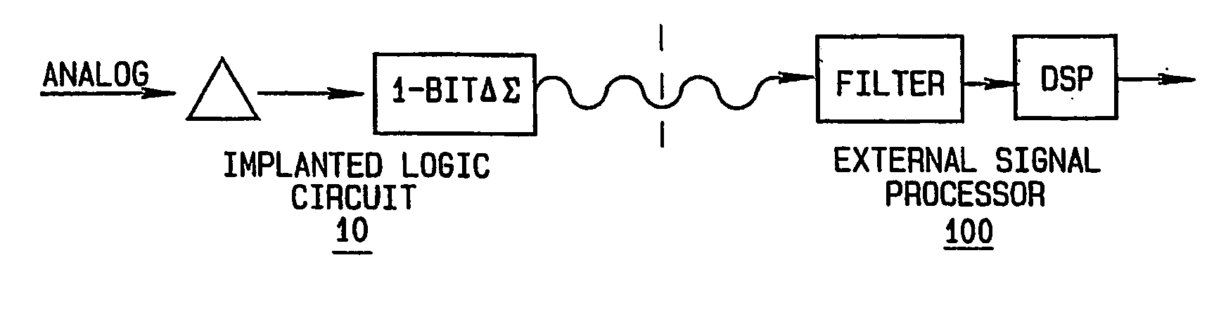 Method and apparatus for wireless brain interface