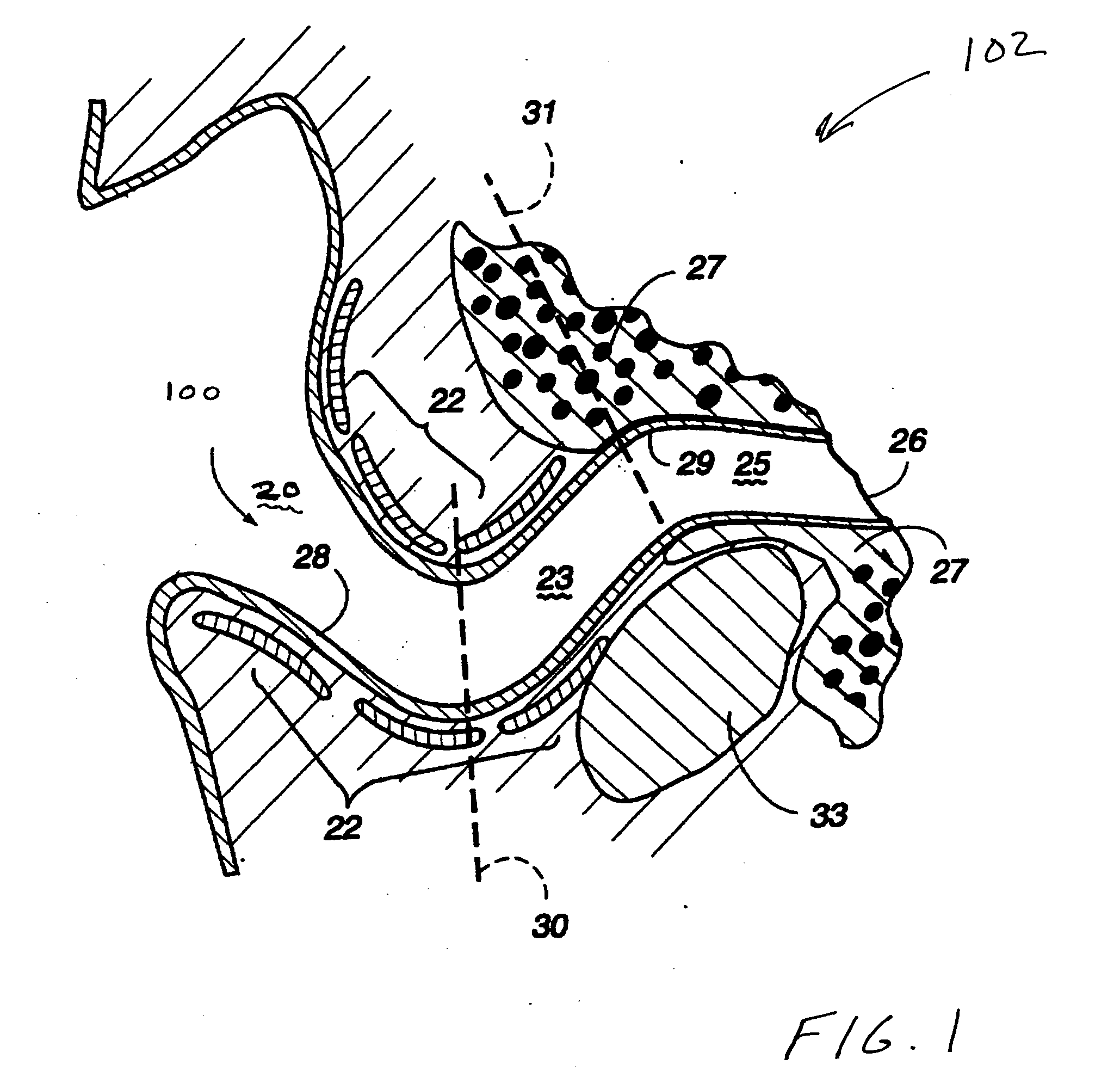 Pulse oximetry methods and apparatus for use within an auditory canal