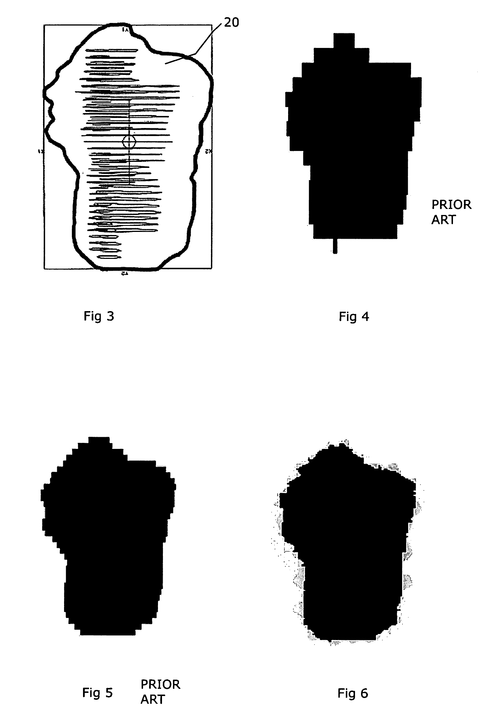 Multi-leaf collimator