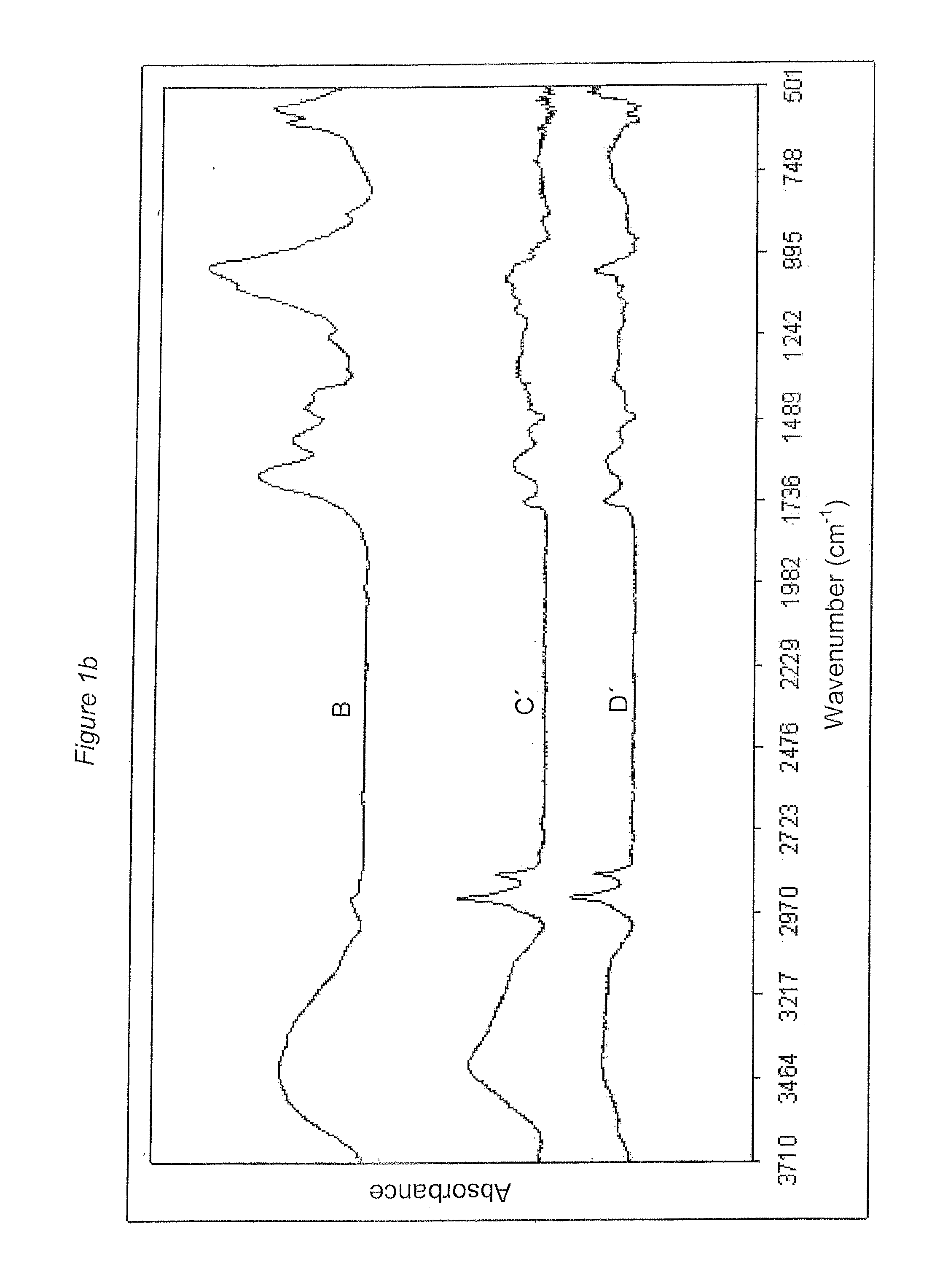 Detection and removal of carious dentin tissue