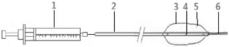 Plugging device capable of injecting hydrogel for ureteroscope lithotripsy