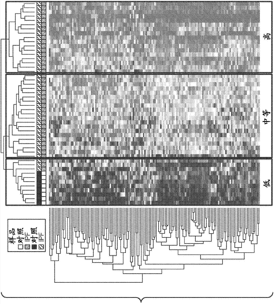 Methods of prognosing, diagnosing and treating idiopathic pulmonary fibrosis