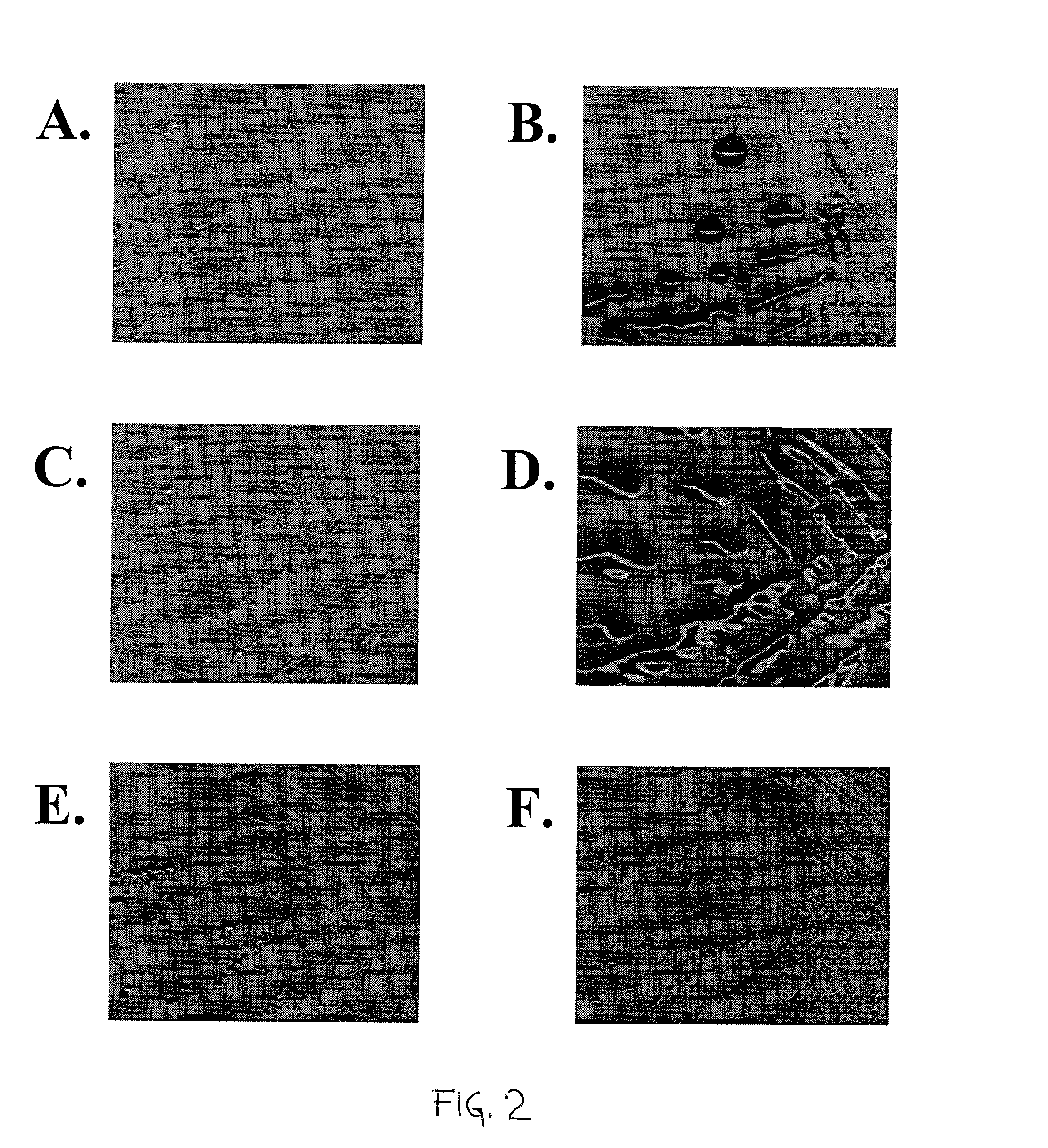 Use of ClyA hemolysin for excretion of proteins