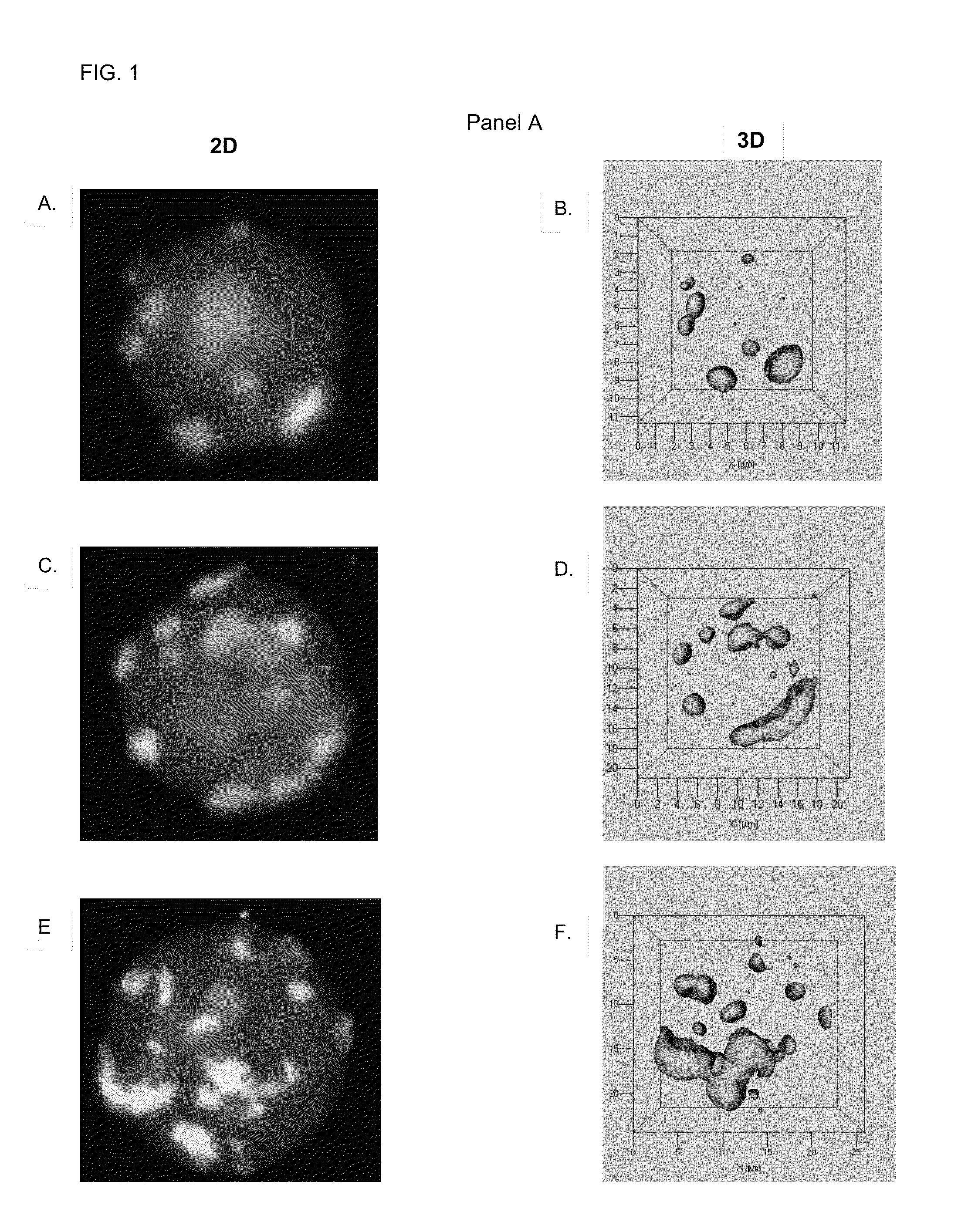 Methods of detecting and monitoring cancer using 3D analysis of centromeres