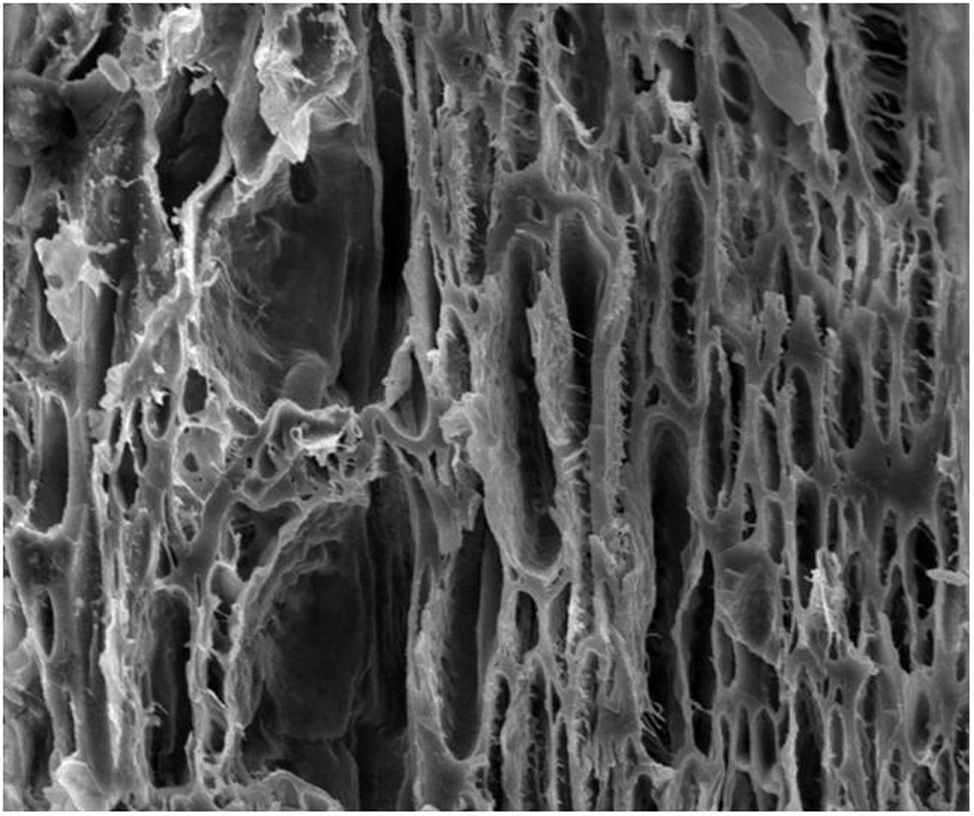 Sodium hyaluronate dressing containing icodextrin