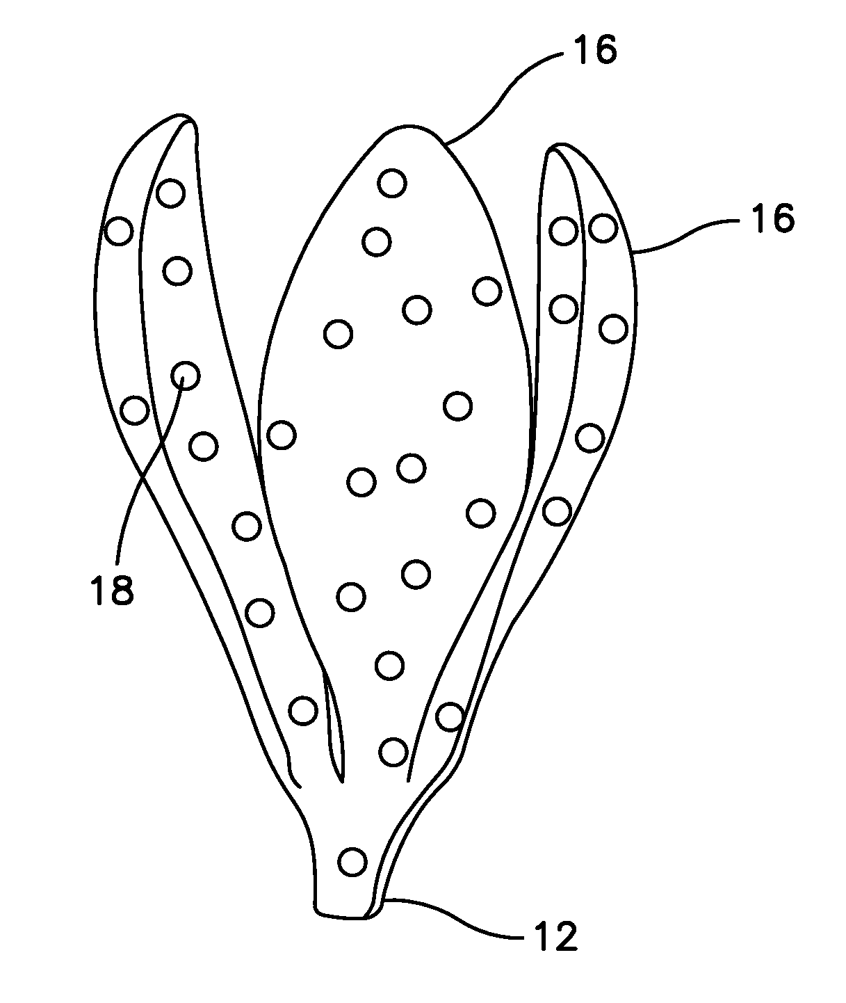 Gastric Sponge System and Use Thereof