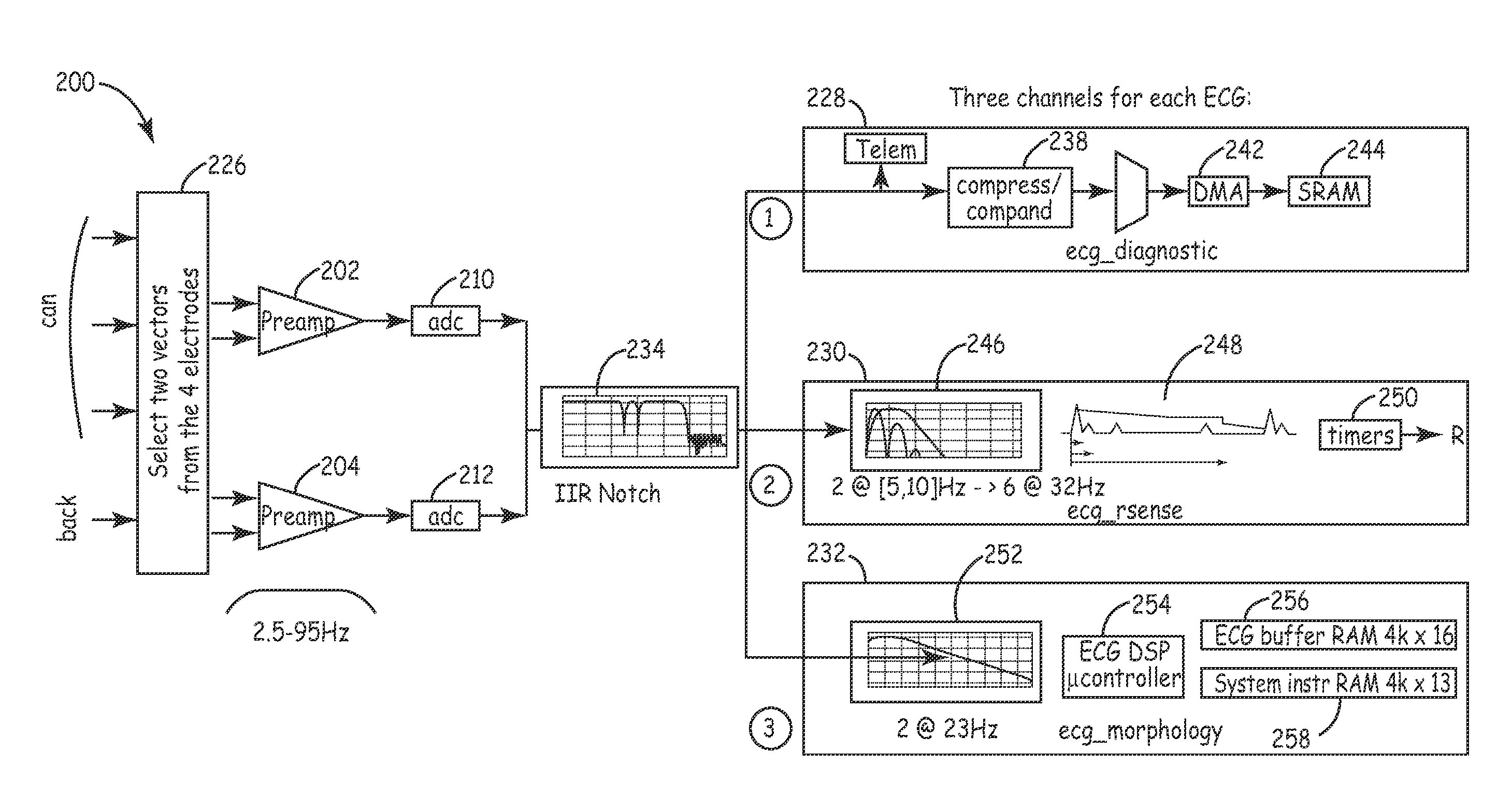 Method and apparatus for detecting arrhythmias in a medical device