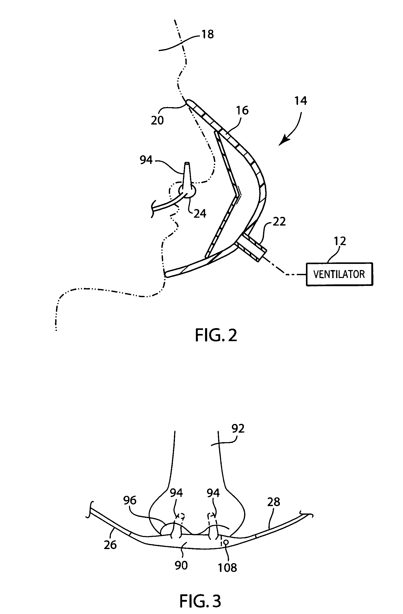 Integrated ventilator nasal trigger and gas monitoring system