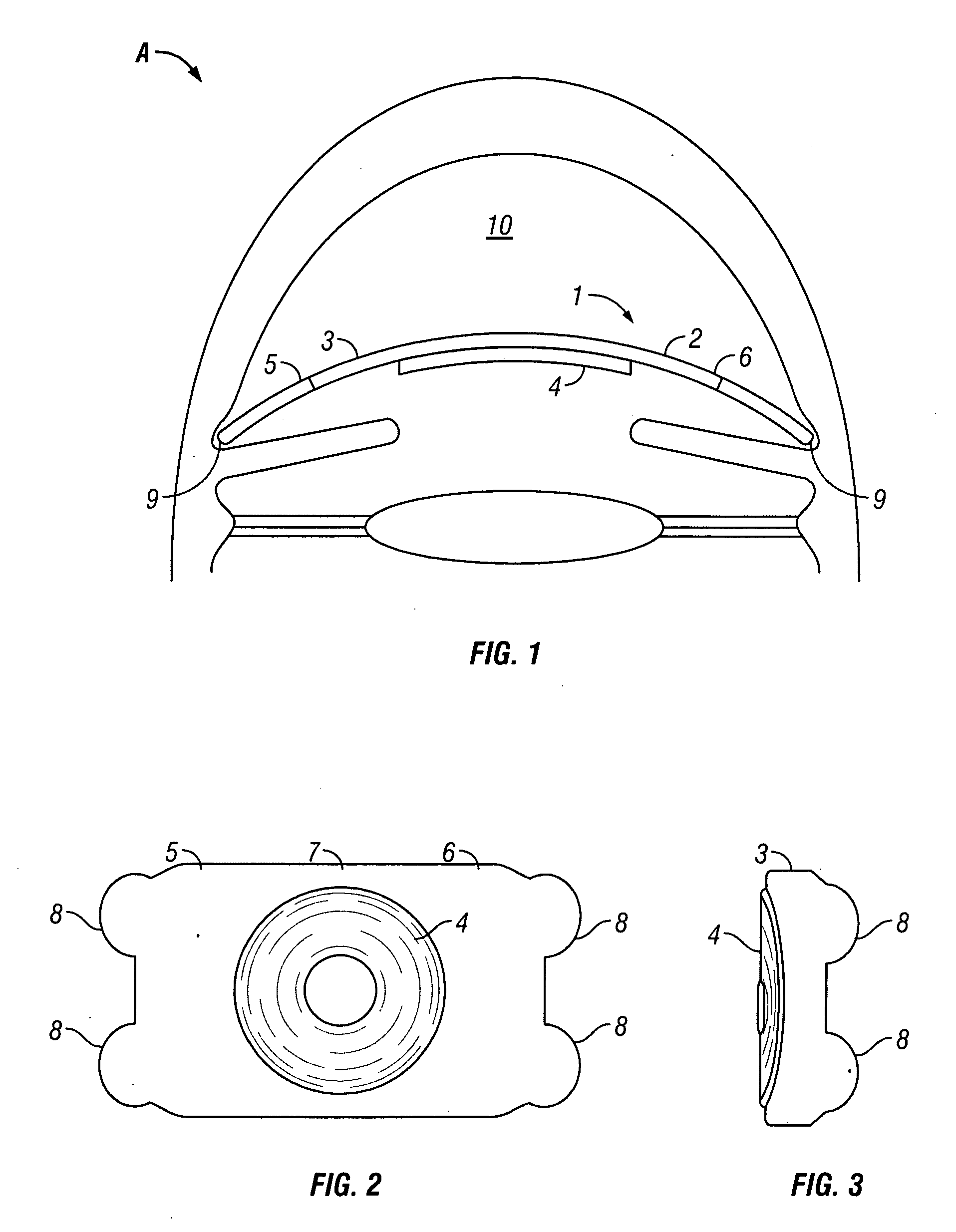 Intraocular thin lens for anterior chamber installation