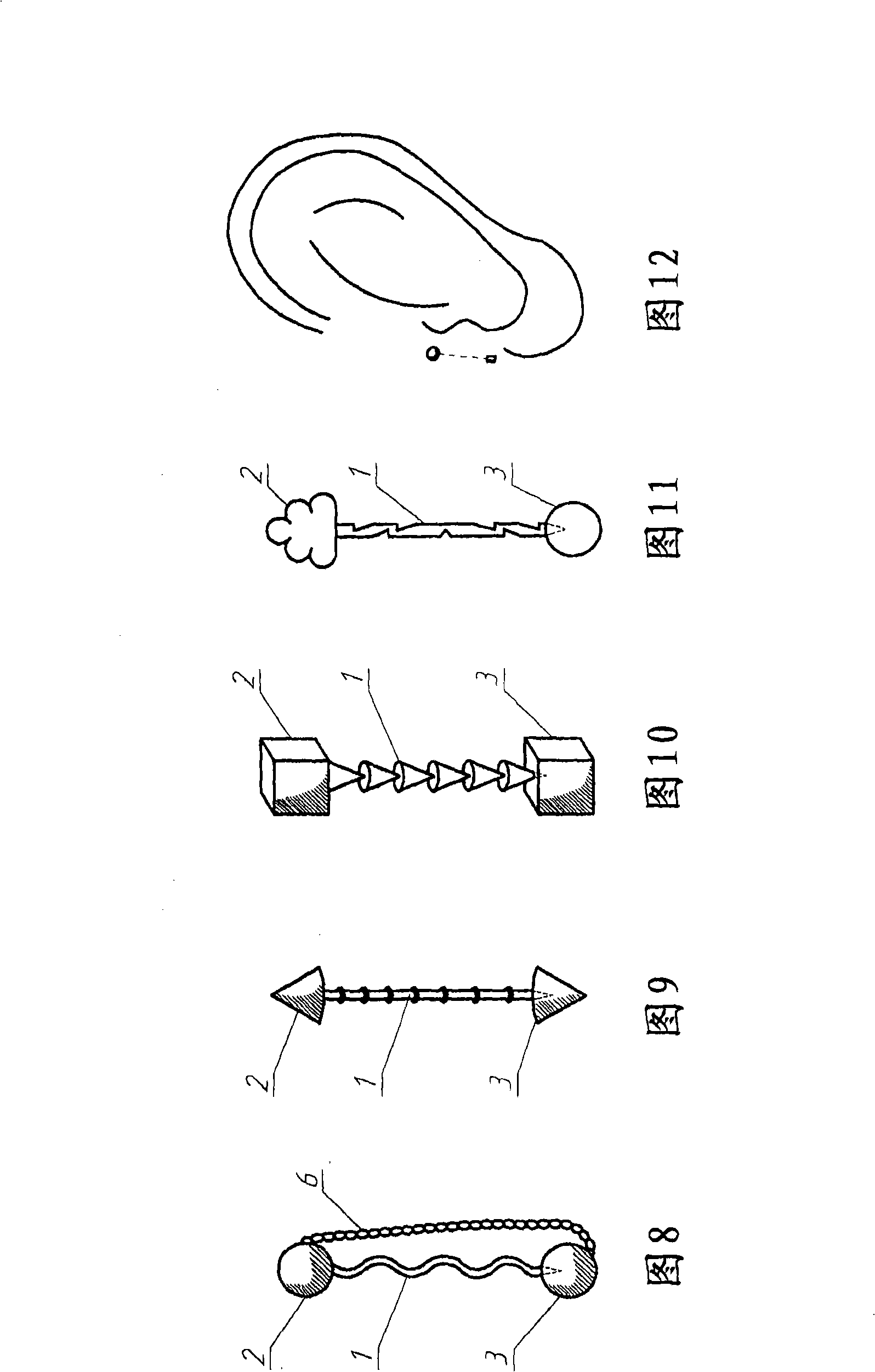 Method for stimulating the organism biochemical reactions for treating organs and tissues, a board for carrying out said method and a board emitter